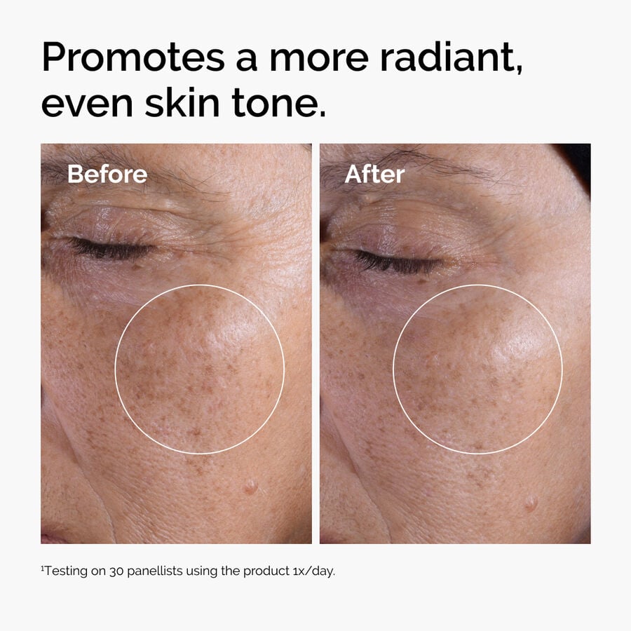 The Ordinary Glycolic Acid 7% Exfoliating Toner Before and After